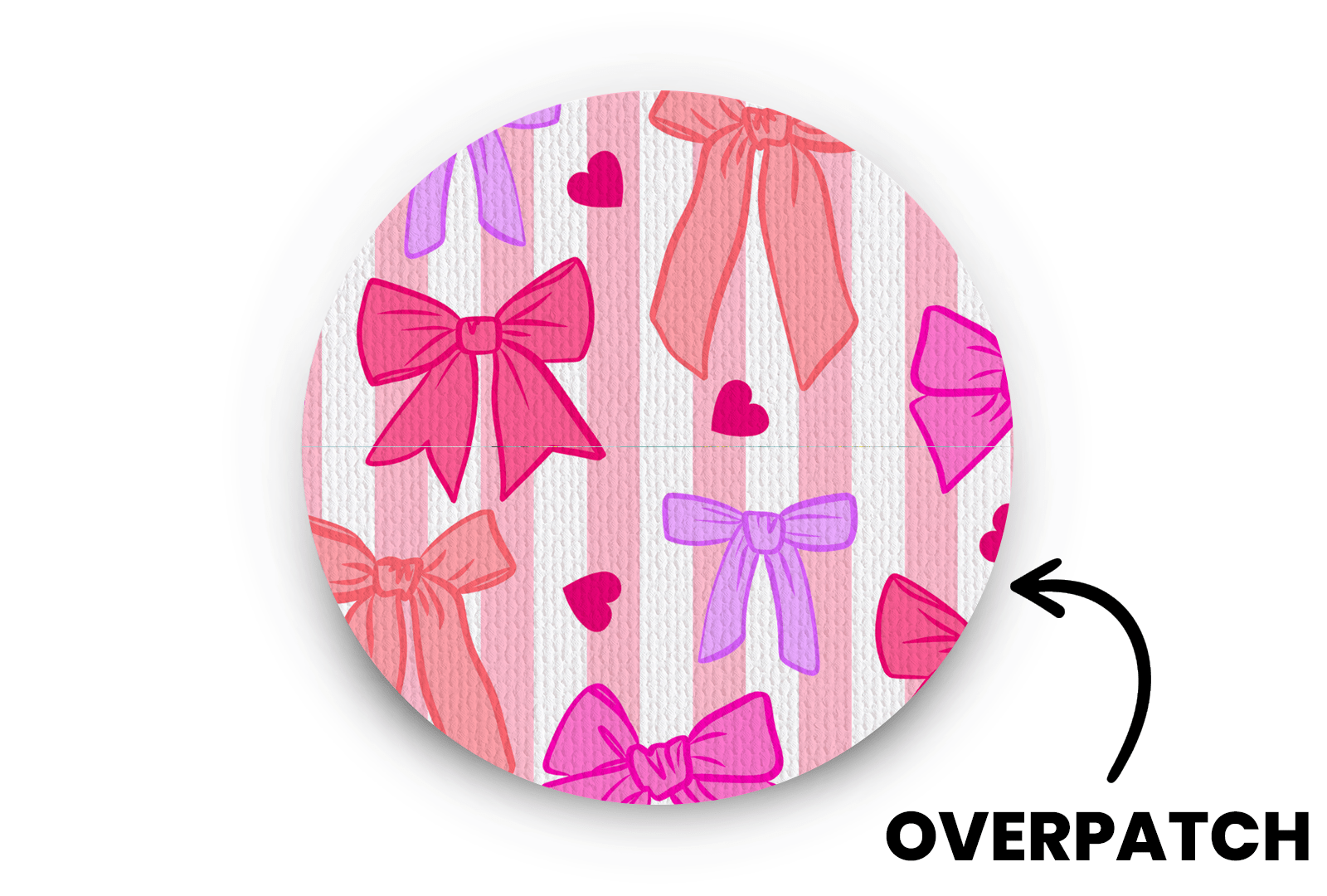 Bows Patch for Generic Overpatch diabetes supplies and insulin pumps