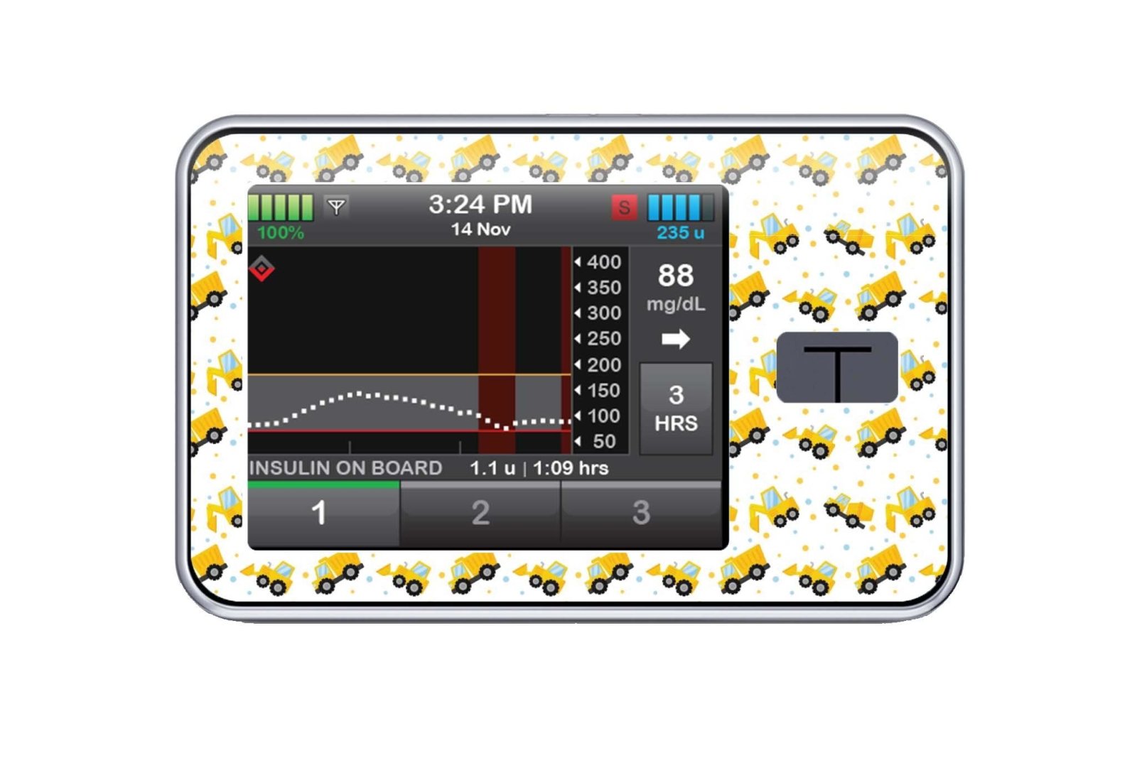 Digger Sticker - T-Slim for diabetes CGMs and insulin pumps