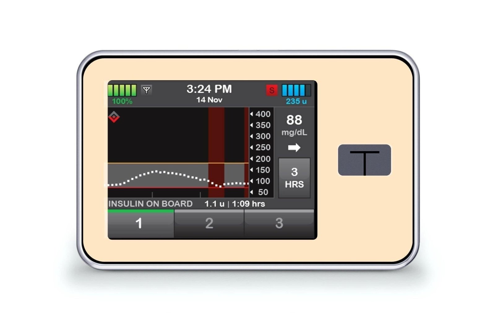 Pastel Orange Sticker - T-Slim for diabetes CGMs and insulin pumps