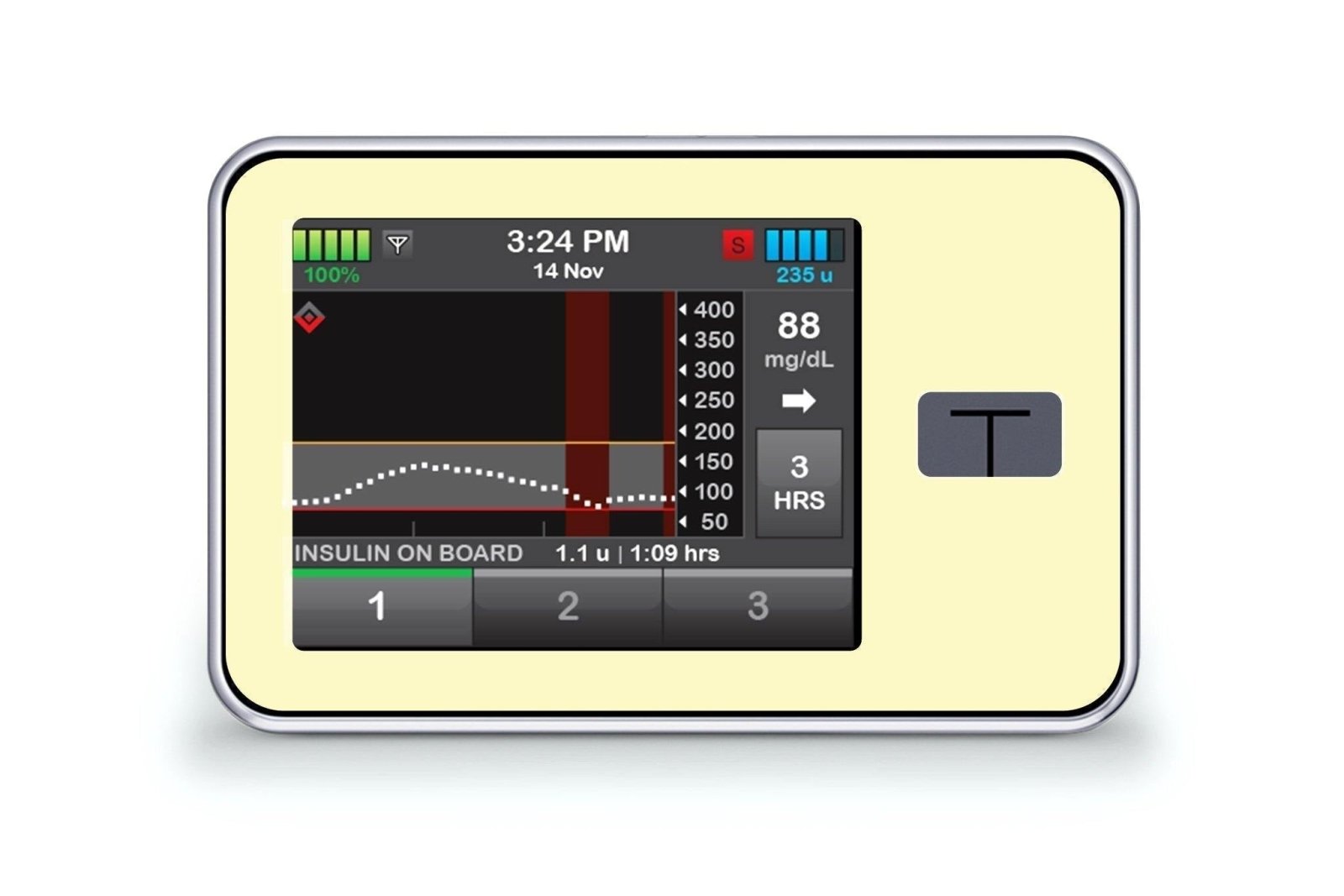 Pastel Yellow Sticker - T-Slim for diabetes CGMs and insulin pumps