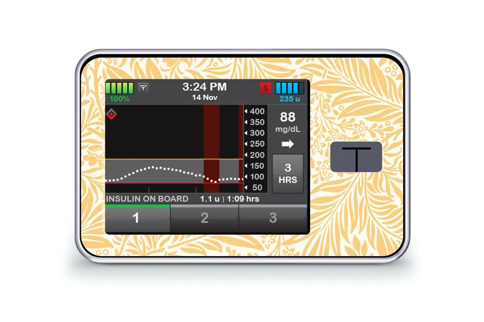 Vintage Yellow Flowers Sticker for T:Slim X2 diabetes CGMs and insulin pumps