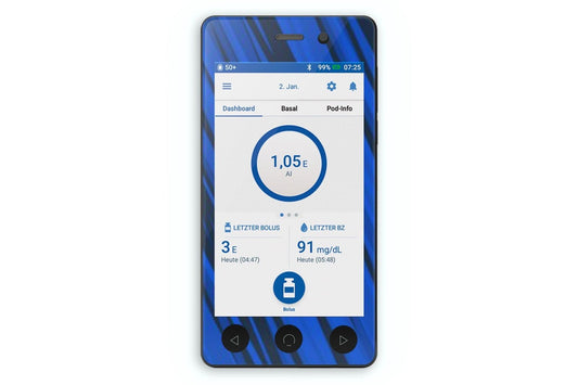 Black And Blue Sports Sticker - Omnipod Dash PDM for diabetes CGMs and insulin pumps