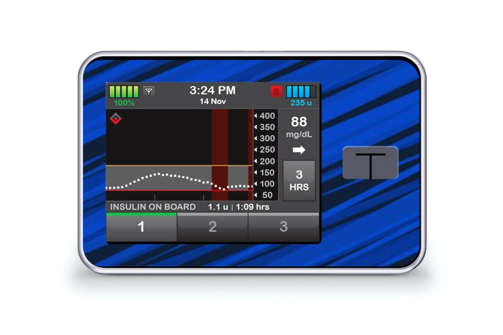Black And Blue Sports Sticker - T-Slim for diabetes CGMs and insulin pumps