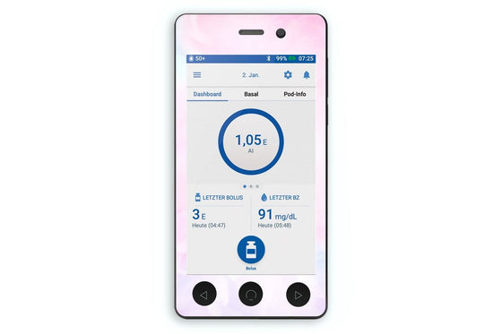 Pink Sky Sticker - Omnipod Dash PDM for diabetes CGMs and insulin pumps