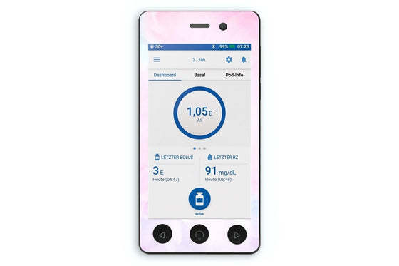 Pink Sky Sticker for Omnipod Dash PDM diabetes CGMs and insulin pumps